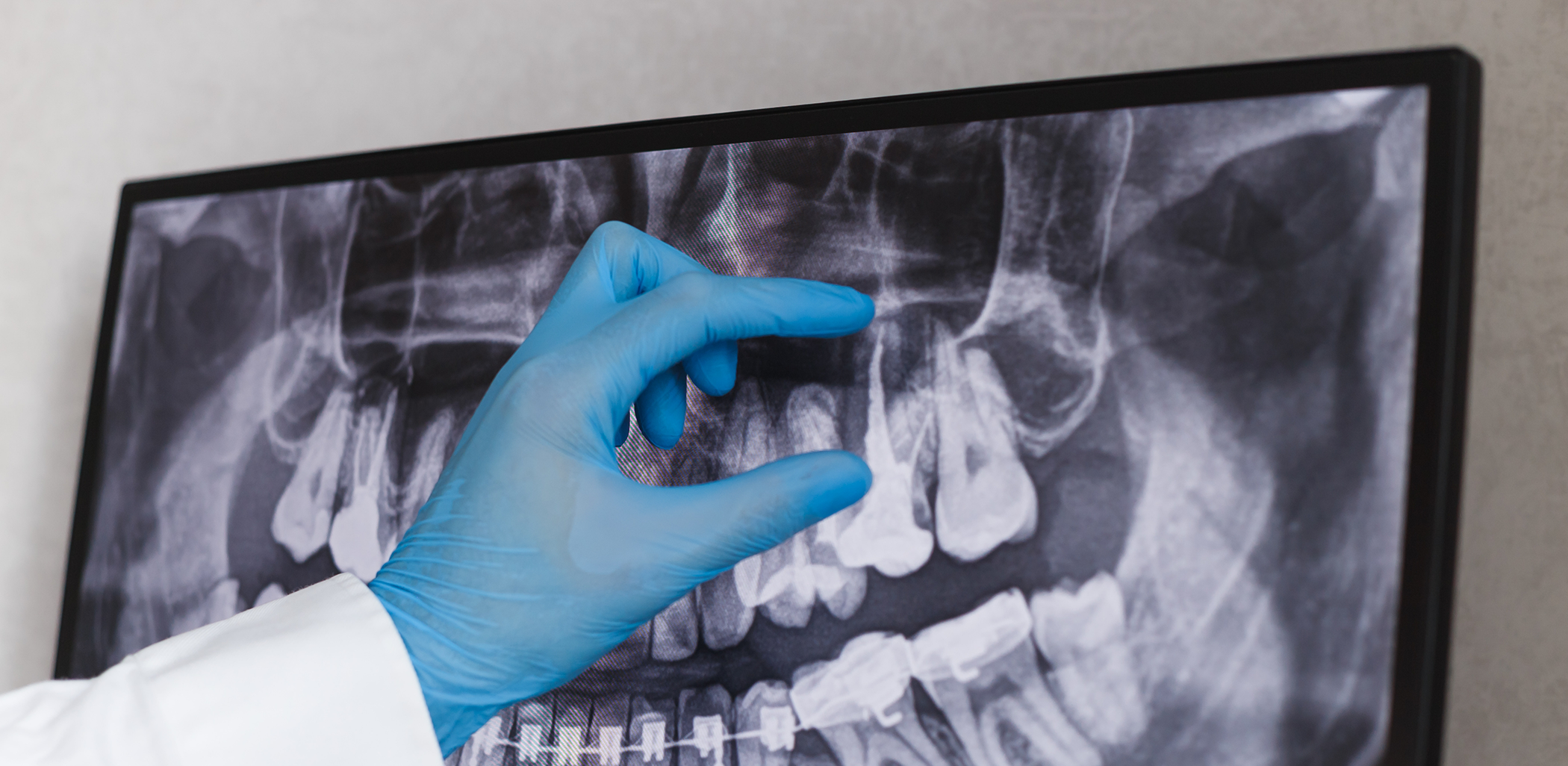 Using gloved hand to zoom in on a dental X ray