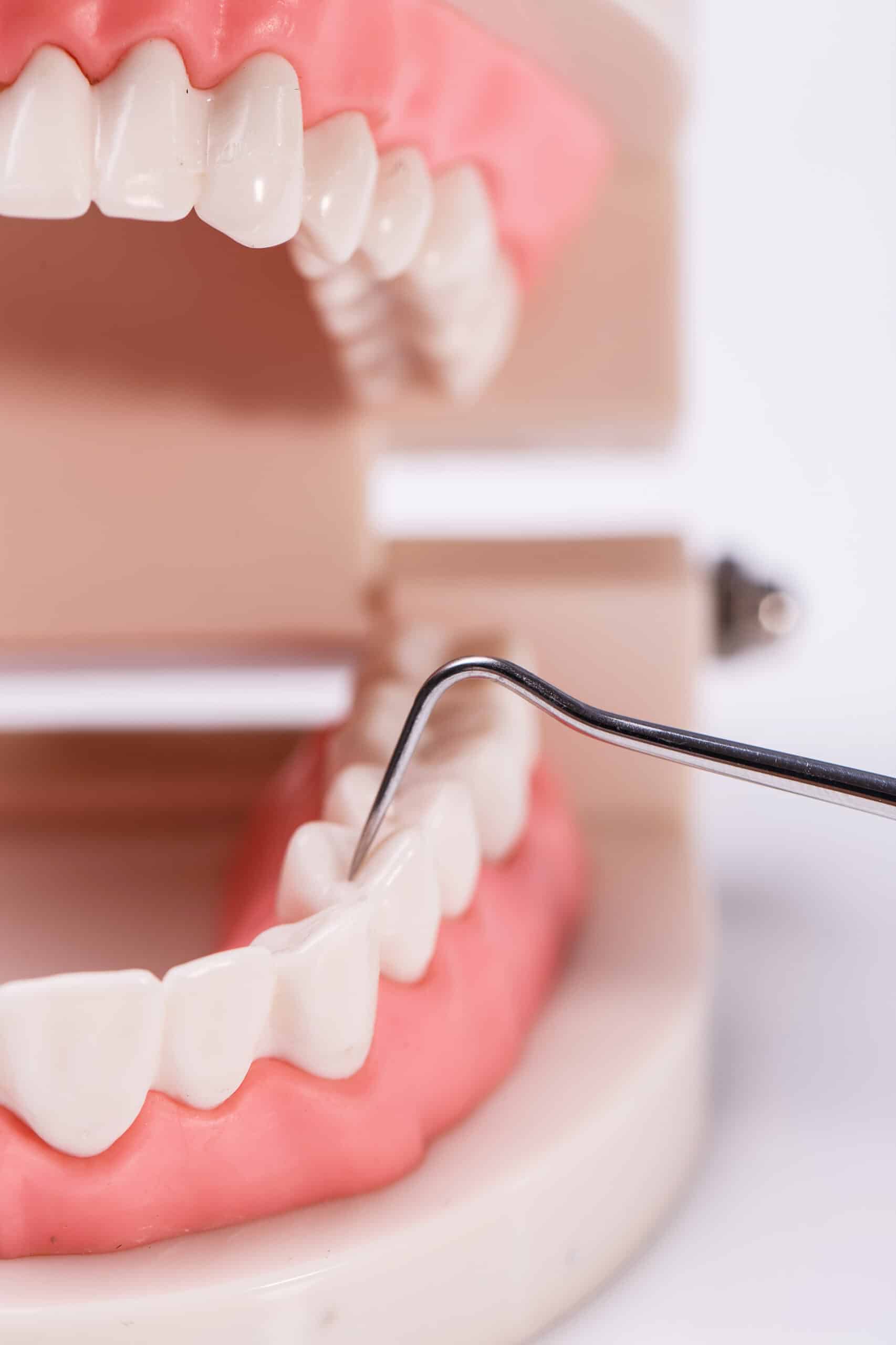 Protect your oral health with our advanced gum disease treatments, designed to treat and manage periodontal issues.